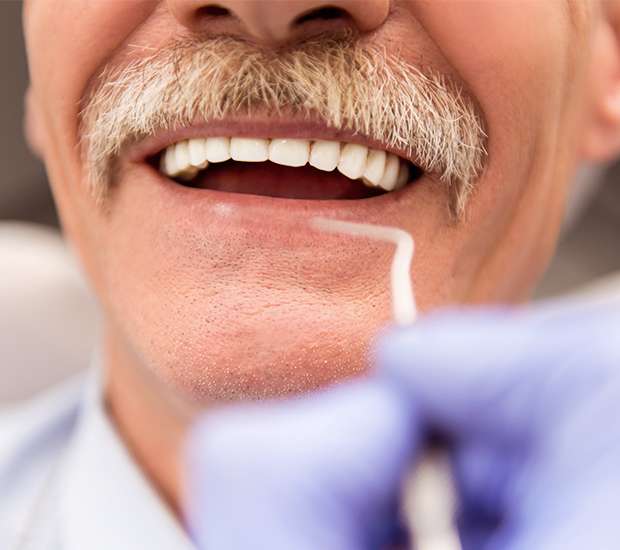 Peoria Adjusting to New Dentures