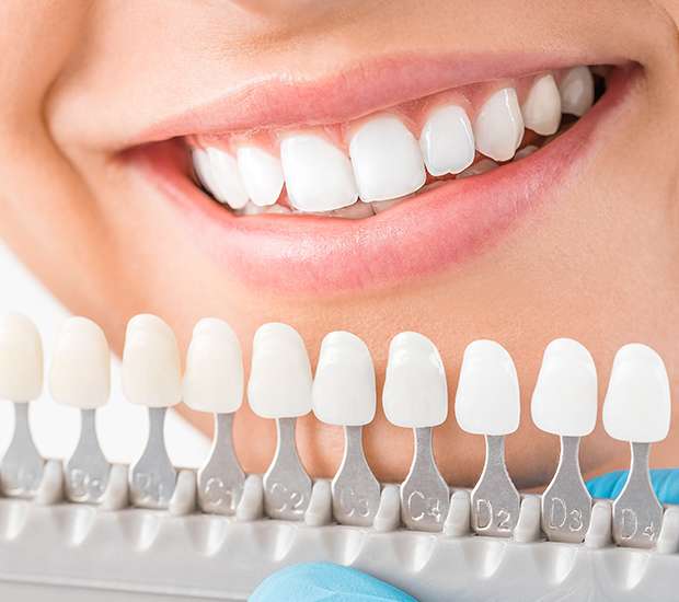 Peoria Cosmetic Dentist