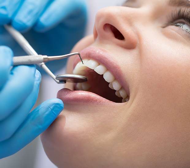Peoria Dental Bonding