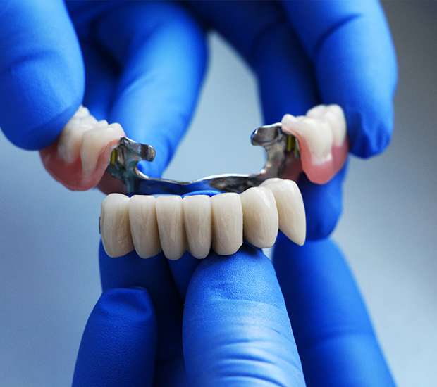 Peoria Dental Bridges