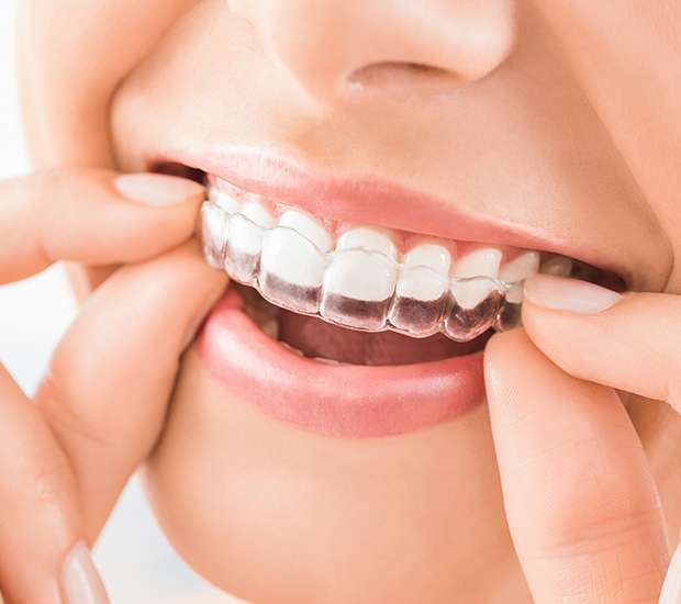 Peoria Does Invisalign Really Work