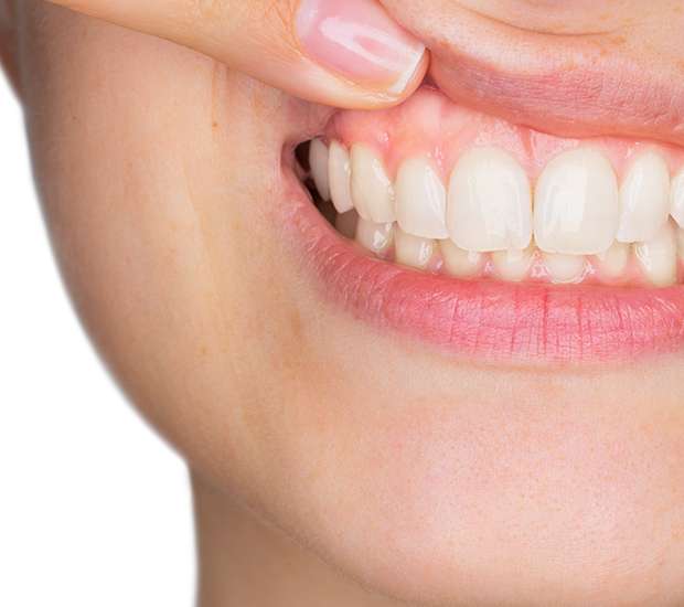 Peoria Gum Disease