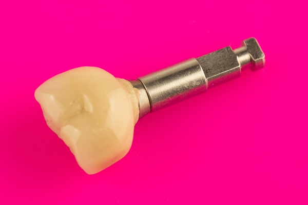 How To Make An Implant Crown Last