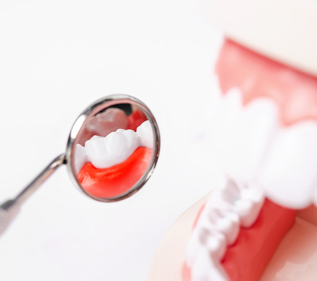 Peoria Interactive Periodontal Probing