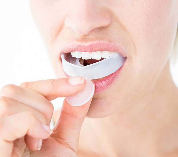 Peoria Mouth Guards