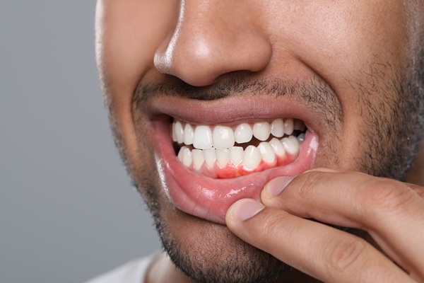 When Would My Dentist Recommend Periodontics?